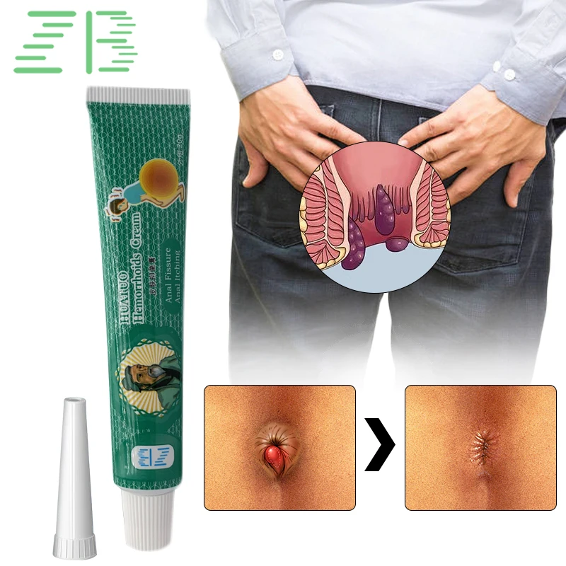 Treatment Hemorrhoids Chinese Herbal Ointment Effective Relief Internal Hemorrhoids Piles External Anal Fissure Outer Plugs Crea