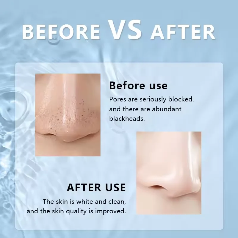 المكتبة الذكية الصغيرة المياه المائية الكهربائية فقاعة المسام الأنظف الوجه أداة آلة جهاز فراغ مزيل الرؤوس السوداء #6