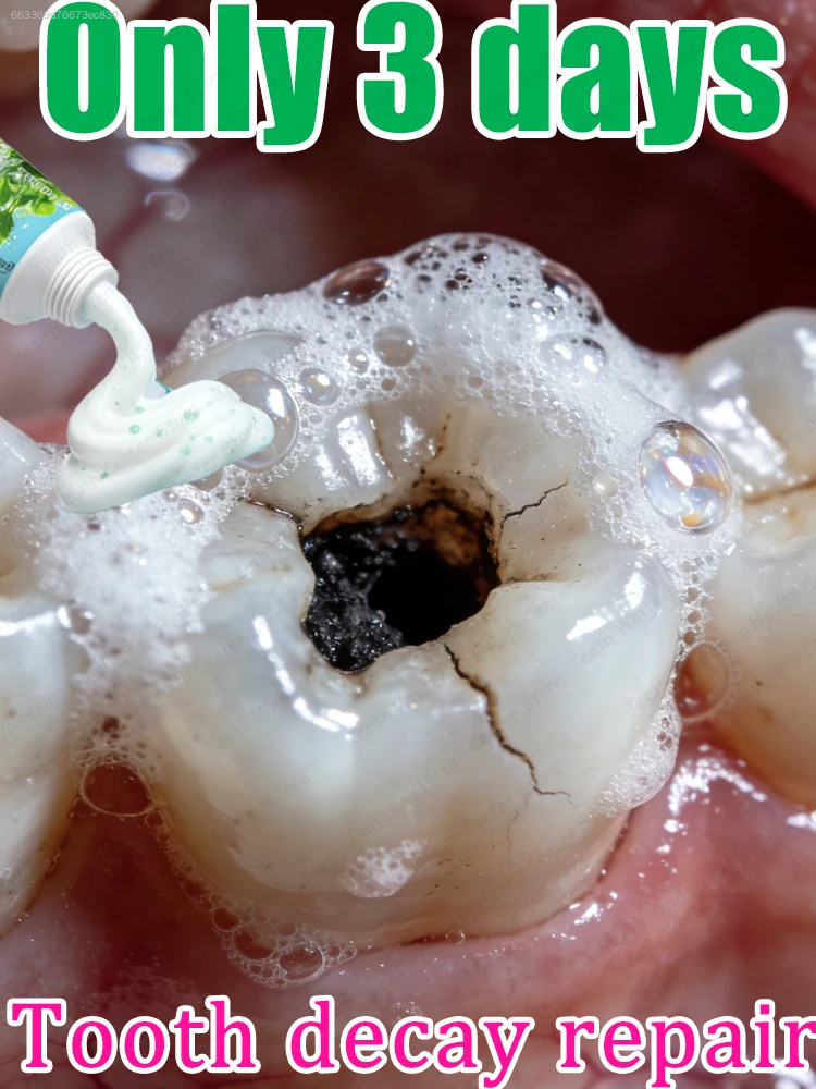 Whitening Toothpaste, Mint Flavor, Freshens Breath, Deep Cleans And Cares For Oral Health, 60g