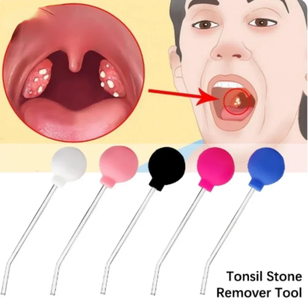 Portable Tonsil Stone Remover Tool Mouth Cleaning Care Tools Ear Wax Tonsil Stone Suction Ball Bad Breath Removal Throat Manual