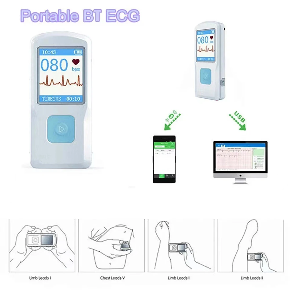 Monitor de ECG Bluetooth portátil, electrocardiograma visible, pantalla a color PM10, monitor de ECG multifuncional digital, carga USB