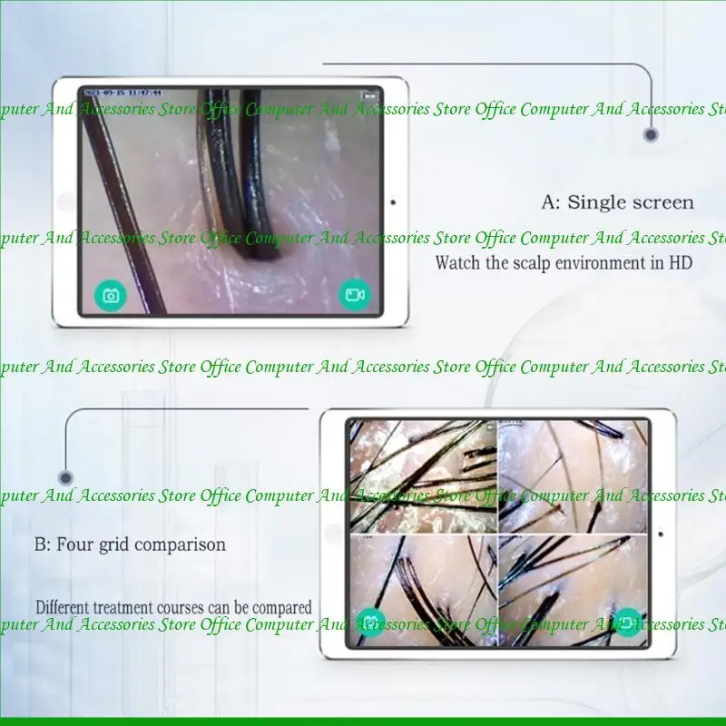 

U55C WIFI Wireless High-definition Hair Skin Follicle Detector Skin