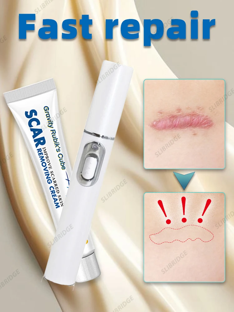 Laser therapy Keloid scar