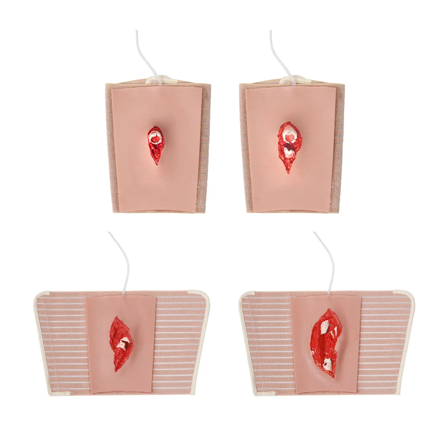 Wearable Fracture Models (Grades 2–5): Bandaging Models for Treating Fractures of Various Severities