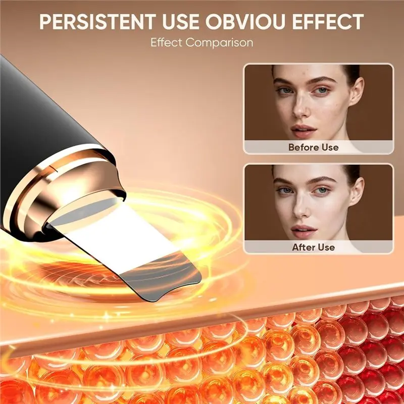 

CYCLI-Силиконовый очиститель для лица, перезаряжаемый, 2-в-1: скребок для удаления черных точек и щетка-лопатка для глубокой очистки кожи