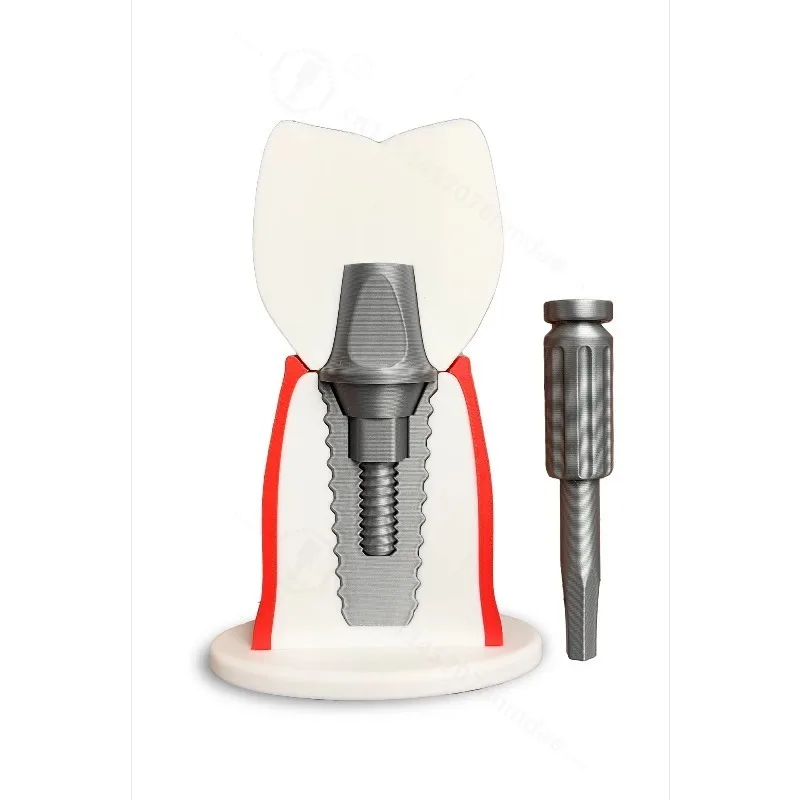 14.5CM High Dental Implant Teaching Demonstration Model Removable Communication Pathology Dental Teaching Aids Simulation