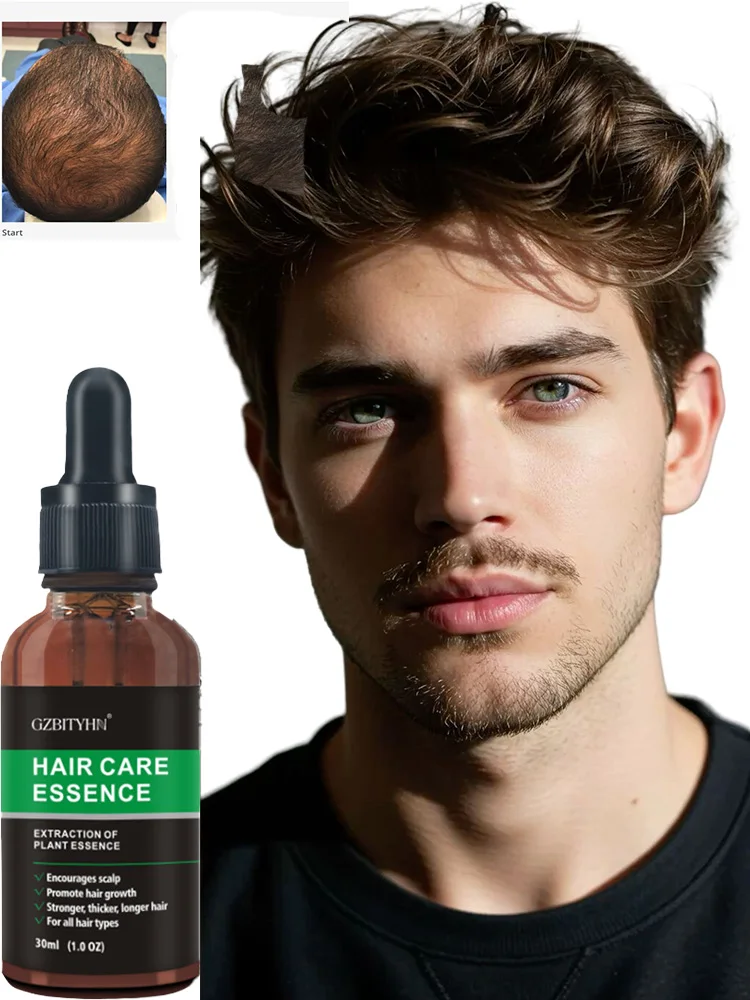 

Our hair growth for mula penetrates the scalp, boosts regrowth, and helps you reclaim thick hair