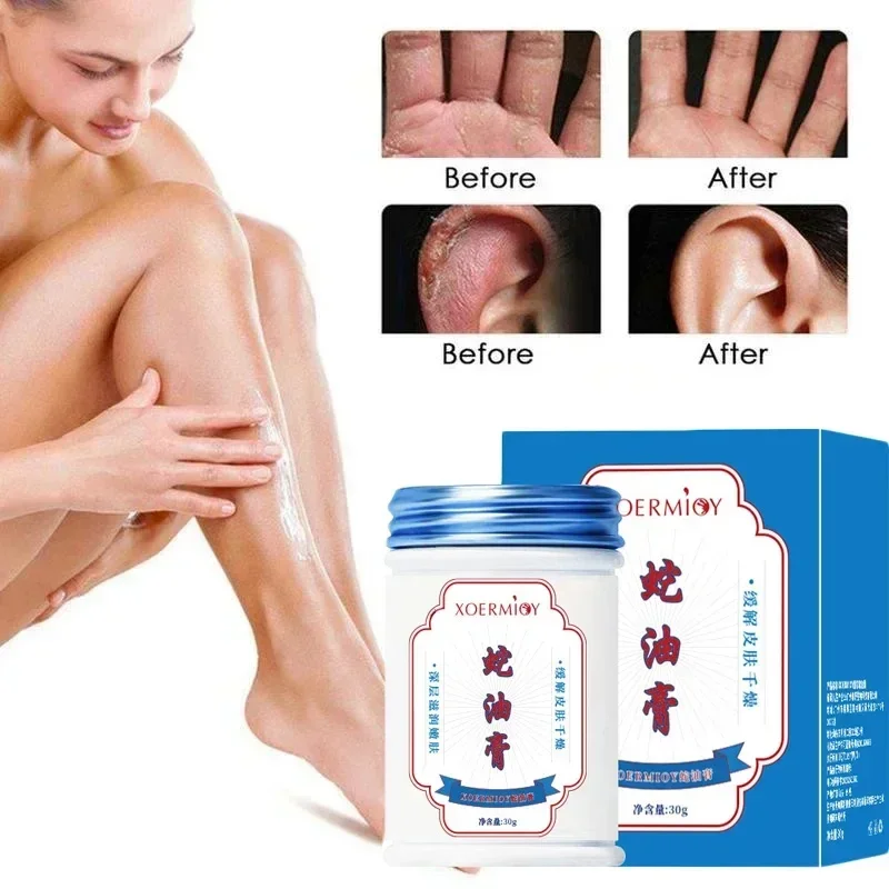 30g Herbal Anti Crack Foot Cream Heel Crack Repair Products Exfoliating Dead Skin Removal Softening Moisturising Skin Care