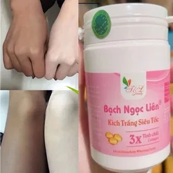 200g Kem kích trắng bạch ngọc liên 3X tinh chat collagen 2in 1 at home kem body siêu trắng Remove dark, brighter whiteness