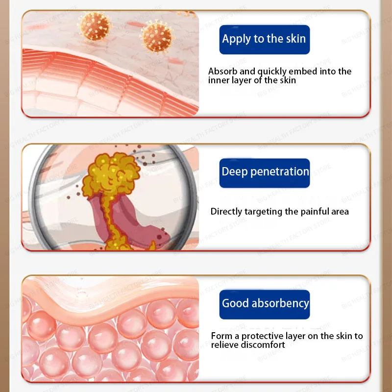 Crème de soin de santé pour follicules pileux, dommages aux follicules pileux, huile pour tête bouchée, démangeaisons et inconfort, crème d'application pour soins externes