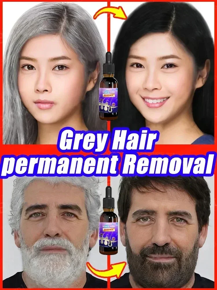 Anti Gray Hair Serum treatment Remedy White Darkening Hair White To Black Natural Color Repair Nourishing Hair Care products