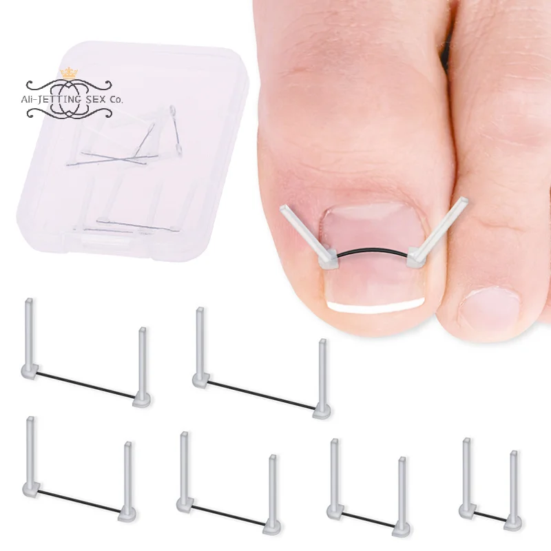 Ingrown Toenail Correction Wire Foot Care Tools Professional Treatment Recover Embed Toe Nail Pedicure Straightening Toe Tools