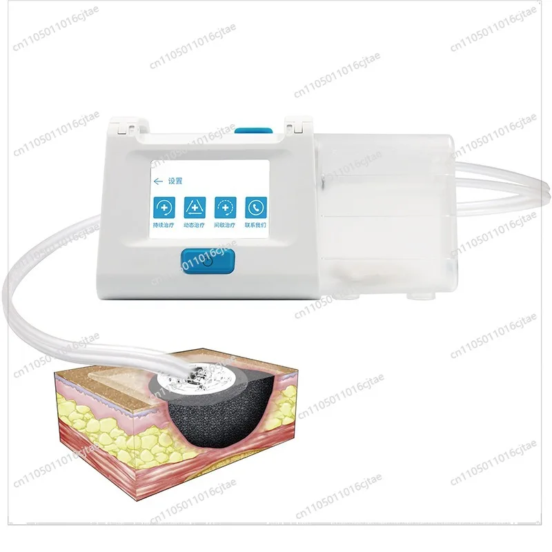 Vsd Negative Pressure Suction Device Medical Portable Vacuum Negative Pressure Suction Device Closed Wound Electric Drainage