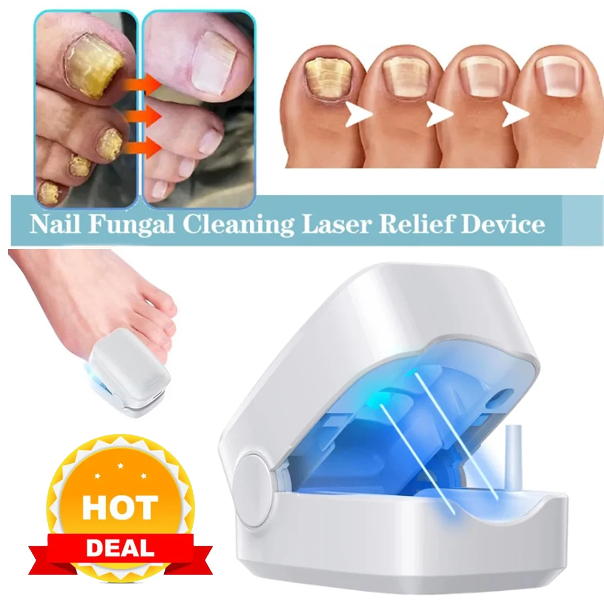 

Nail Fungus Cleaning Laser Device Treatment Repair Toenail Fingernail Fungus Onychomycosis Remover Cure Therapy Machine