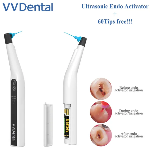 VVDental Aktywator Dentystyczny Sonic Irrigation Ultrasonic Endo Activator Kits & 30 Elastycznych Końcówek do Czyszczenia Kanałów Korzeniowych w Stomatologii