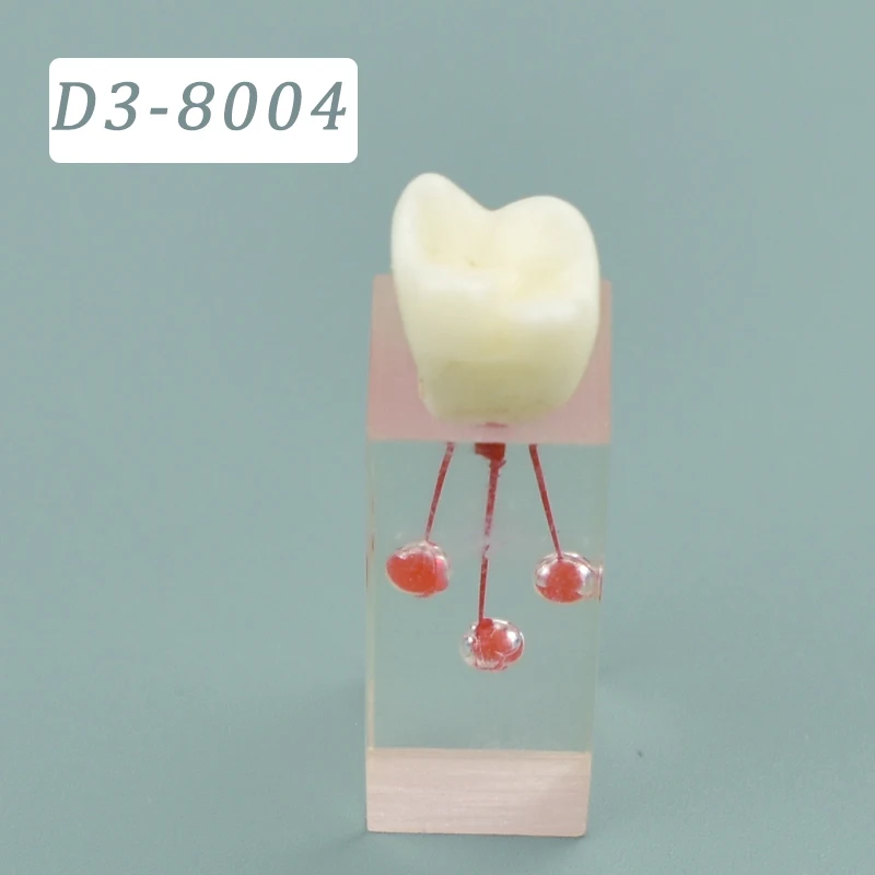 Dental Resin Root Canal Teaching Practice Mode Dental Pulp Training Module Dental Teaching Display