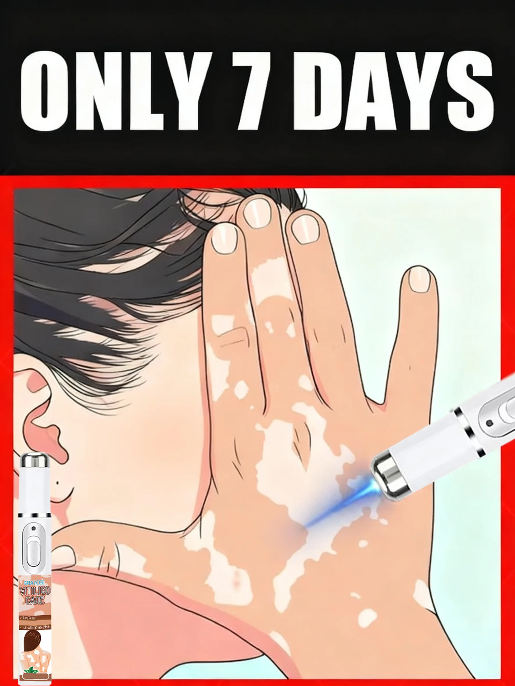 2025, neues Upgrade, Blaulichtstift, lösen Sie Vitiligo-Werkzeug