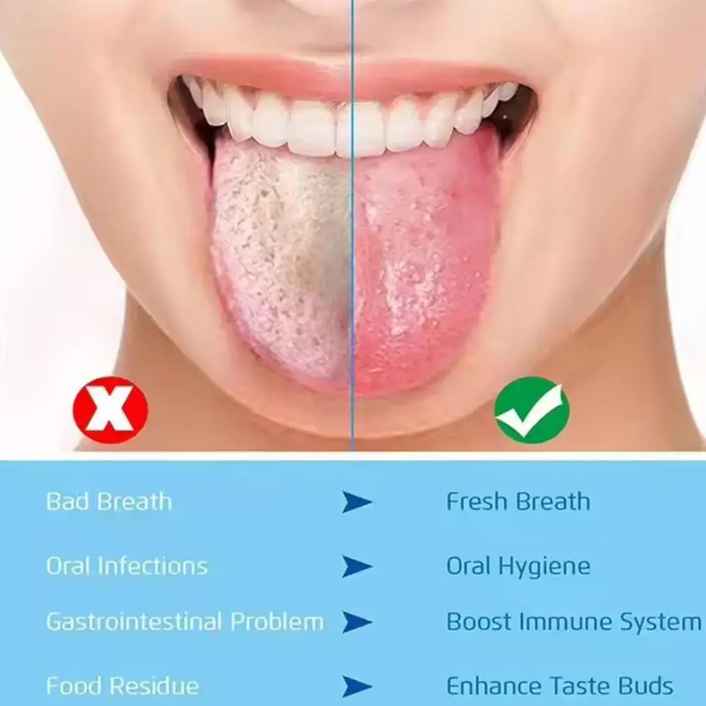 Nettoyeurs de langue avec brosse, grattoir, ningBad Breath, formule douce, gel de livres, élimine les odeurs buccales, soins de la langue