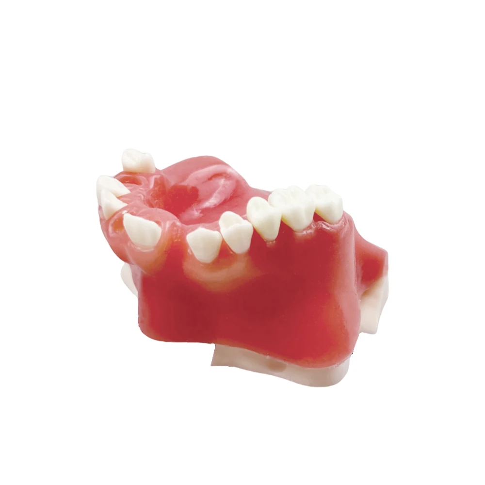 

Maxillary Sinus Implant Practice Model Dental Soft Gums Upper Jaw Sinus Lift Implant Restoration Teeth Teaching Study Model Demo