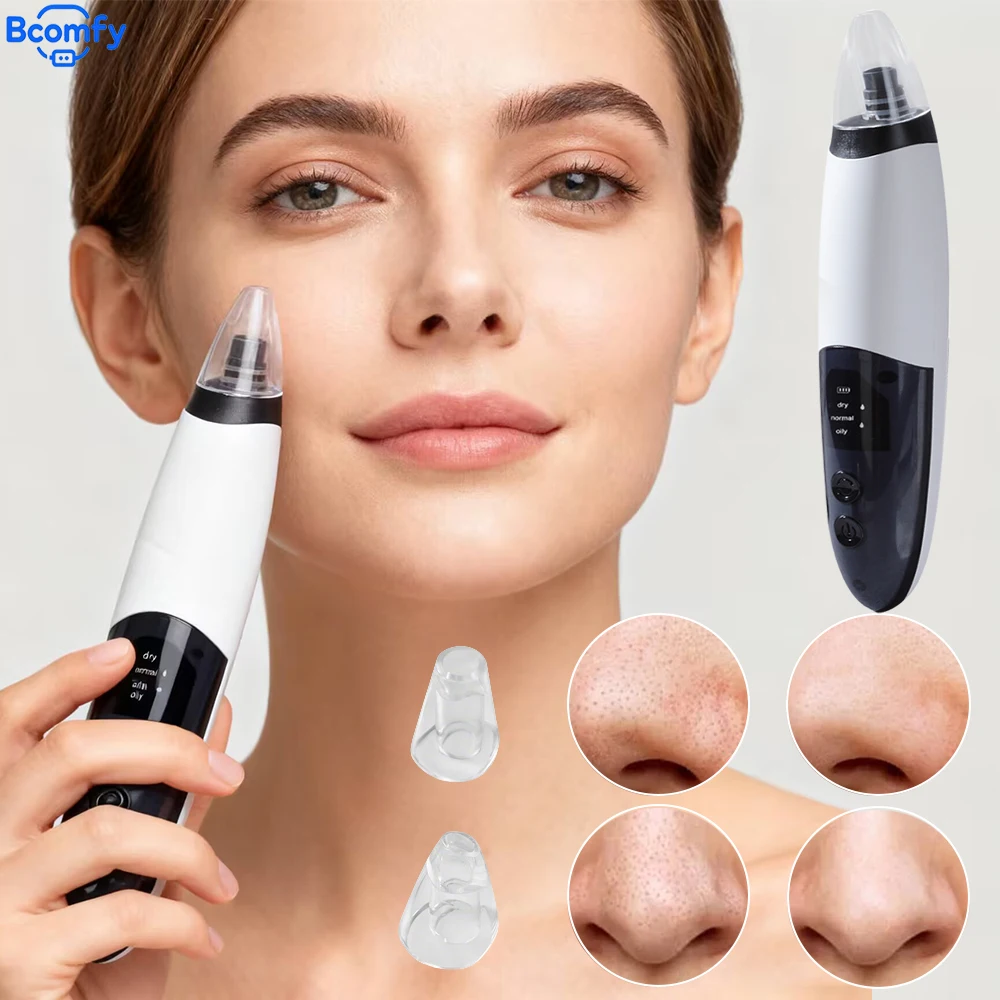 フェイスバキューム黒ずみ除去器 3つの吸引モード付き スキンクレンジング美容機器 角質除去 スキンケアツール