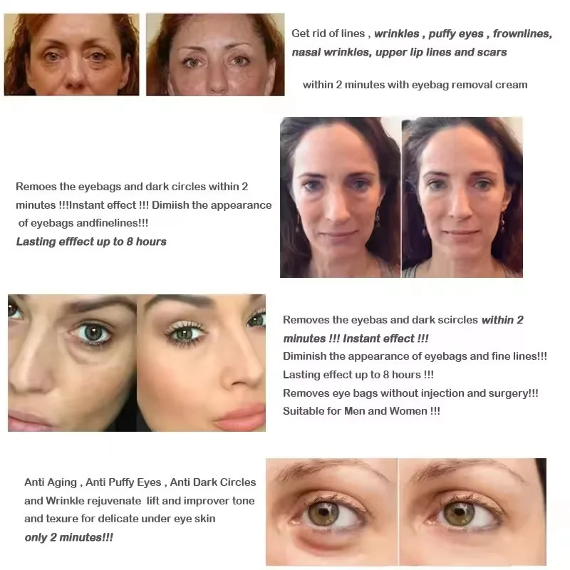 Crema de eliminación instantánea de bolsas de ojos, Retinol, antiarrugas, reafirmante, decoloración de líneas finas, antiángulo oscuro, hinchazón, ilumina el producto para el cuidado de los ojos