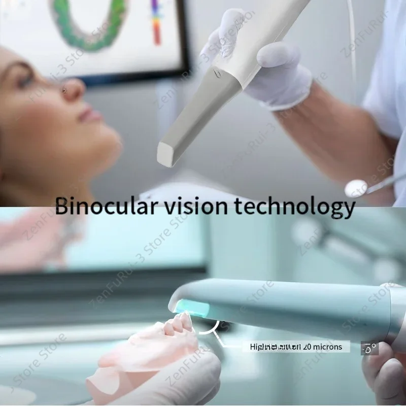 Digital Intraoral Scanner, Dental Oral 3D Scanning Device For Dental Clinic Lab Restoration Work