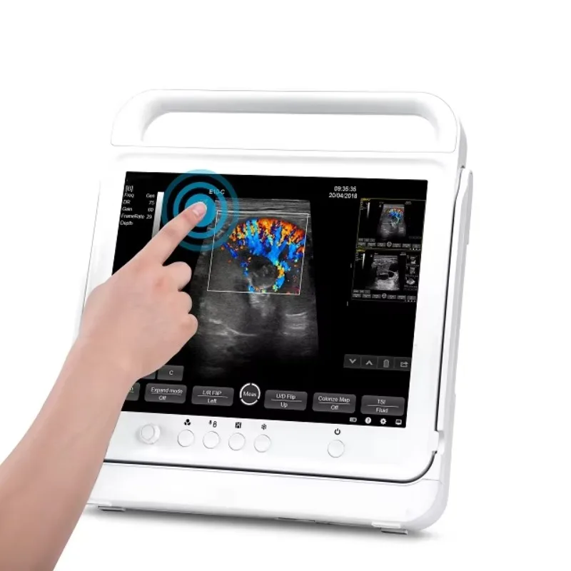 Lightweight Touchscreen Handheld Ultrasound Scanner, Portable Color USG Machine
