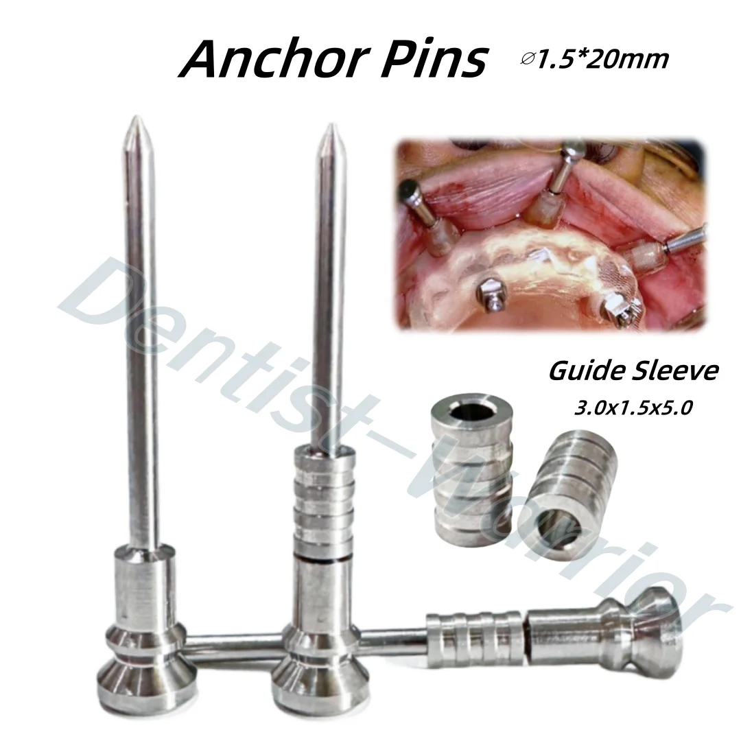 

∅1.5 Стоматологический анкерный штифт Анкерные фиксирующие штифты Цифровой универсальный управляемый рукав 3x1,5x5 мм