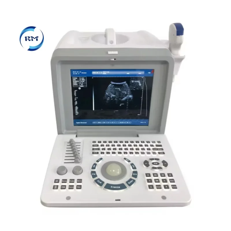 Human use Clinic Medical Black and White Ultrasonic Machine Full Digital LED Portable Ultrasound Scanner