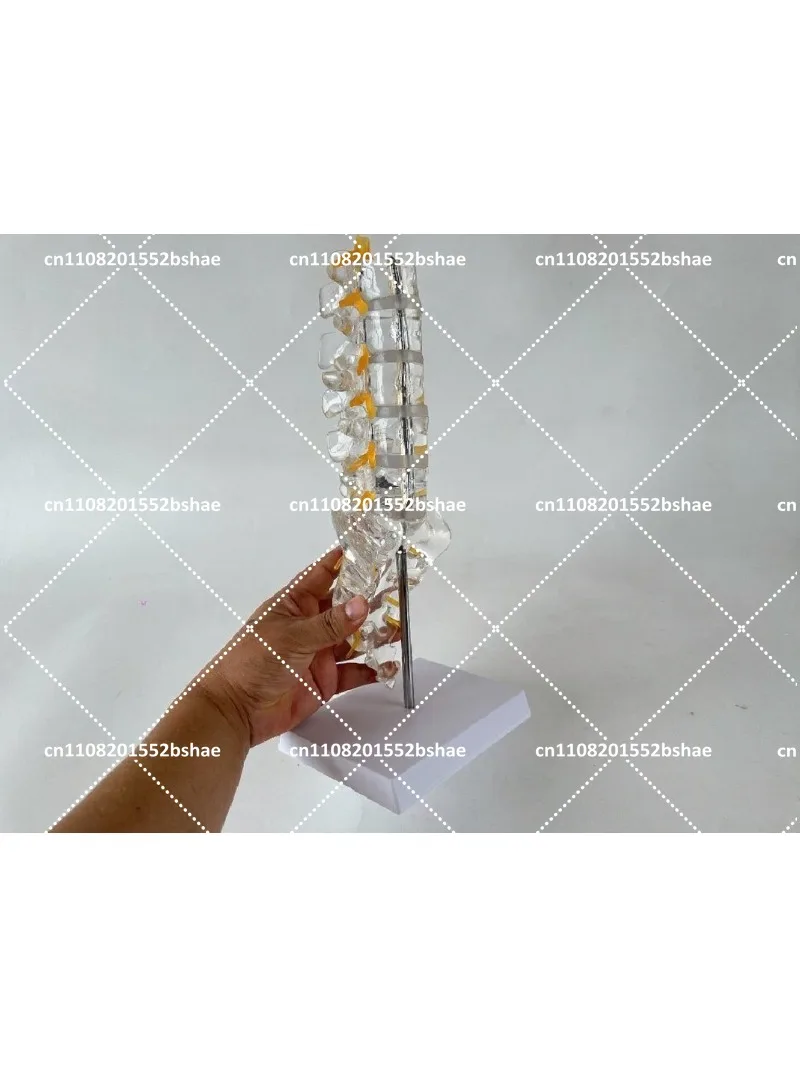 Transparent Lumbar Spine Model with 5 Section Flexible Herniated Disc Spinal Nerve Root Sacrum for Orthopedic Education