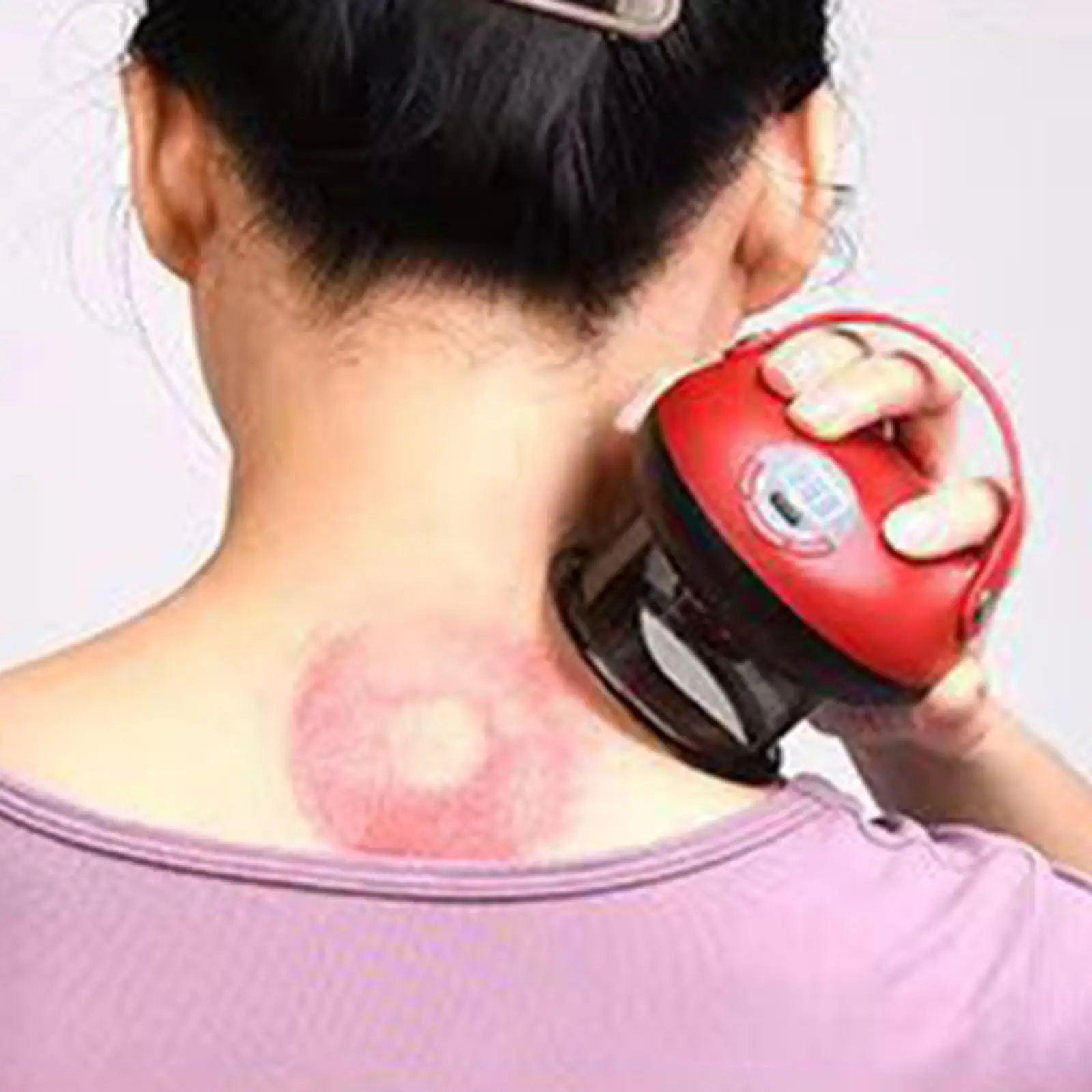 목 다리 어깨용 부항 기계 충전식 부항 마사지 장치