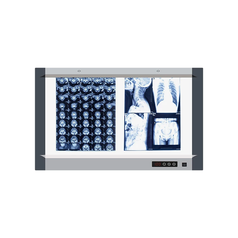 China Professional Double Panel Medical Led X-ray Film Viewer Negatoscope for Mammography