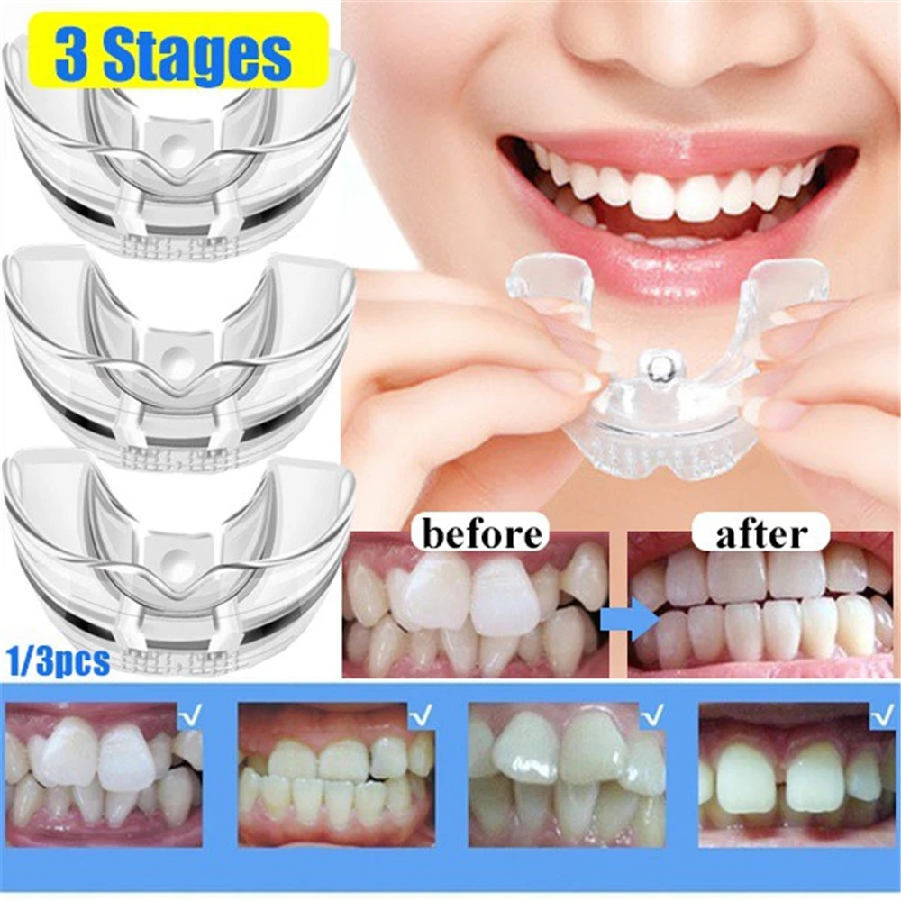 3 Stages Silicone Tooth Invisible Orthodontic Set Dental Appliance Teeth Retainer Mouth Guard Braces Tooth Tray Tooth Care Tool