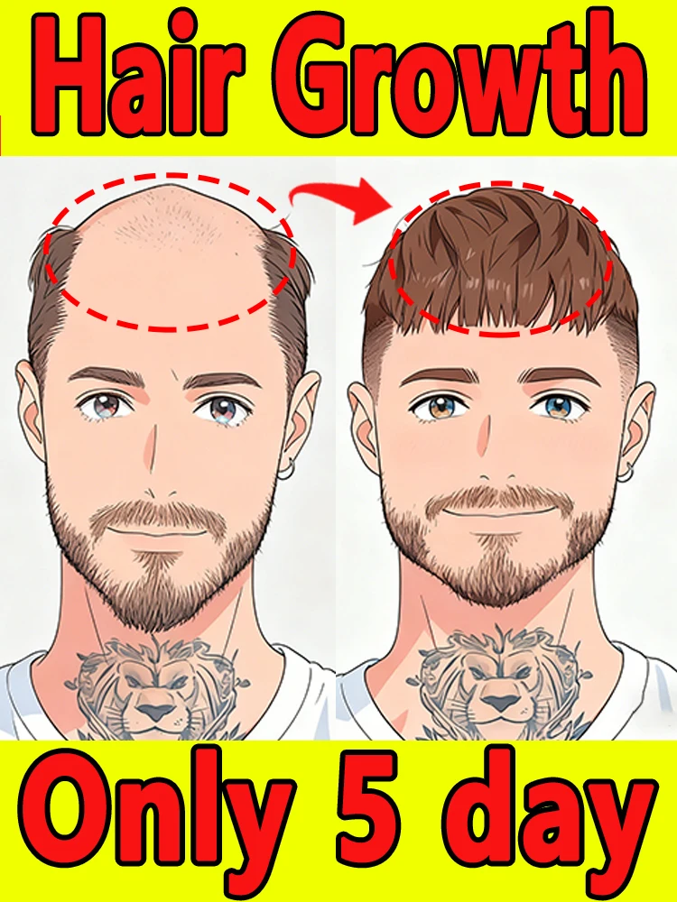 

Say Goodbye to Oily Hair and Hair Loss in 2025: The Ultimate Hair Care Tool – Control Oil and Prevent Hair Loss in One Step