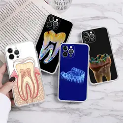 Dentist Tooth Phone Case For iPhone 15 14 13 12 Mini 11 Pro XS Max X XR SE 6 7 8 Plus Soft Silicone Cover