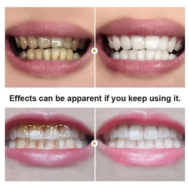 Dental Cleaning Powder Whitening Natural Toothpaste Pearl Essence Teeth Polishing Remove Plaque Brighten Clean Freshen Breath