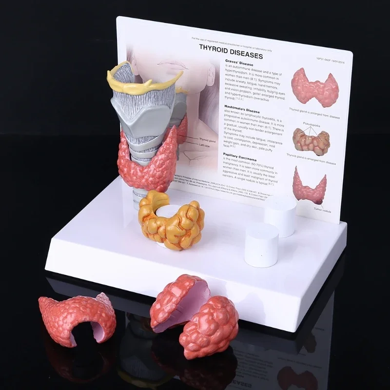 Human Anatomical Thyroid Gland Model Pathology Anatomy Digestive System Display Study Teaching Tool Halloween