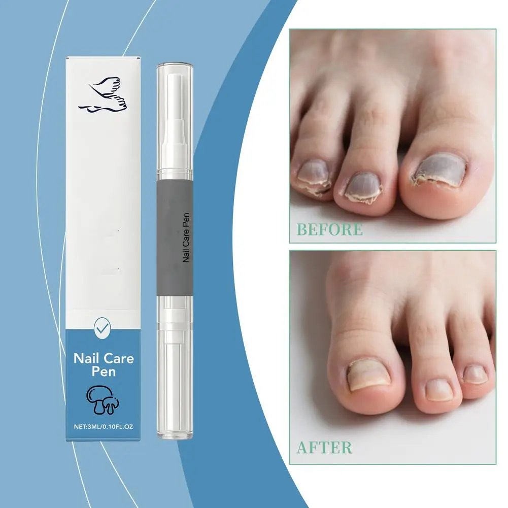 

1pcs 3ml Nail Care Pen – Strengthen, Moisturize & Repair Weak Formula with Nails Dry, Oils & Antioxidant Natural G1G3