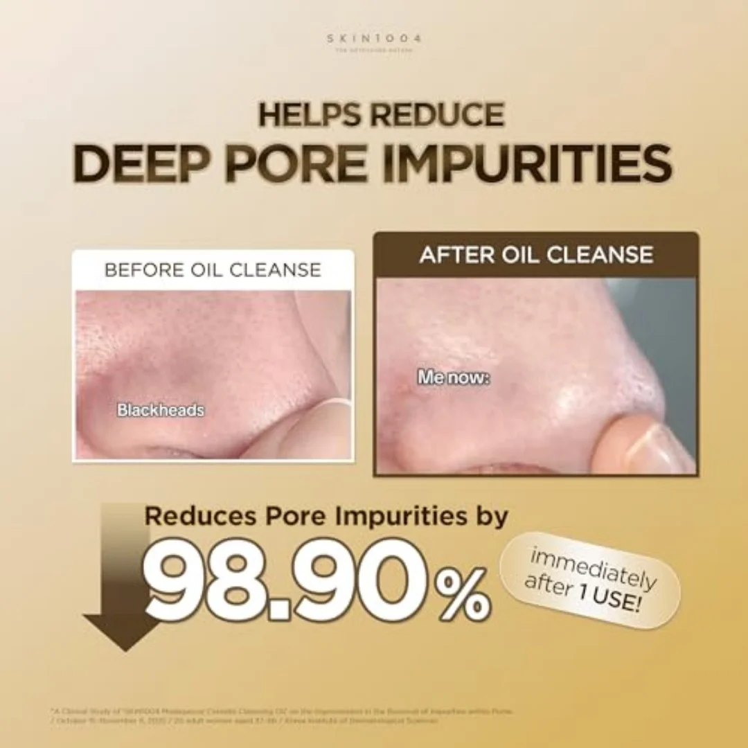 Thumbnail 2 - #32 Latest Facial Cleansers Offers