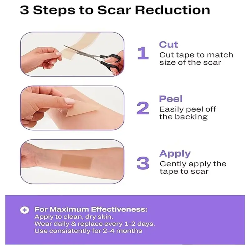 A73U For Keloid, Surgery C-Section,& Chronic Wound Scar Sheets Roll 4Pcs-Silicone Scar Tape-Soft Non-Irritating