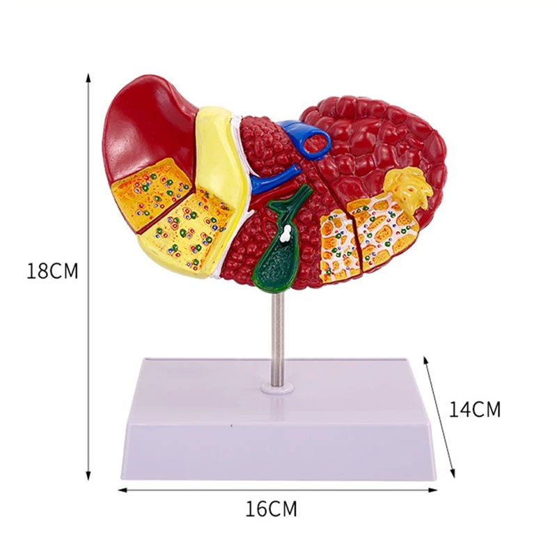 نموذج الكبد نموذج الكبد المرضي لعلم الأمراض المشتركة، نموذج الكبد نموذج تشريح مكتب التشريح البشري
