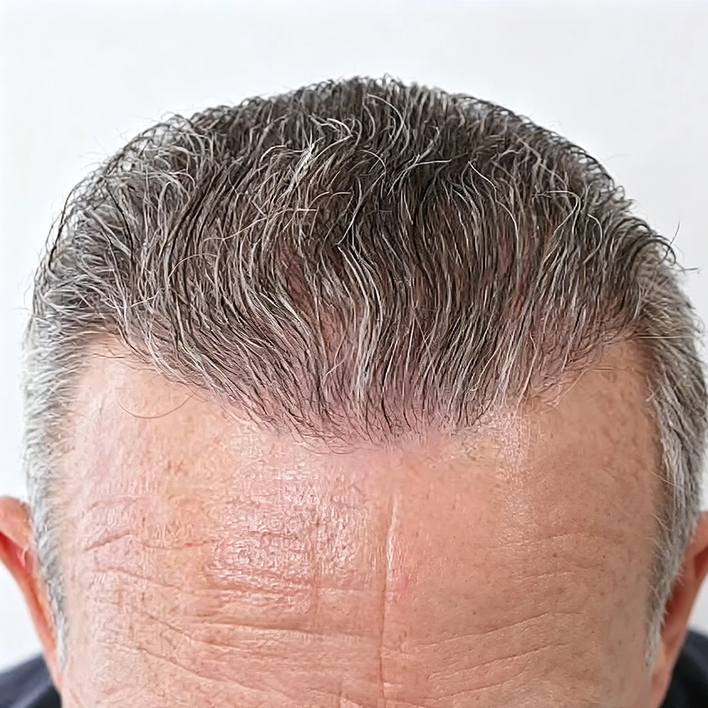 Natural Hairline 0.02mm Super Thin Skin Base Men's Toupee 80~90% Density 1b20 520# Grey Hair Old Male Human Hair Capillary Prost