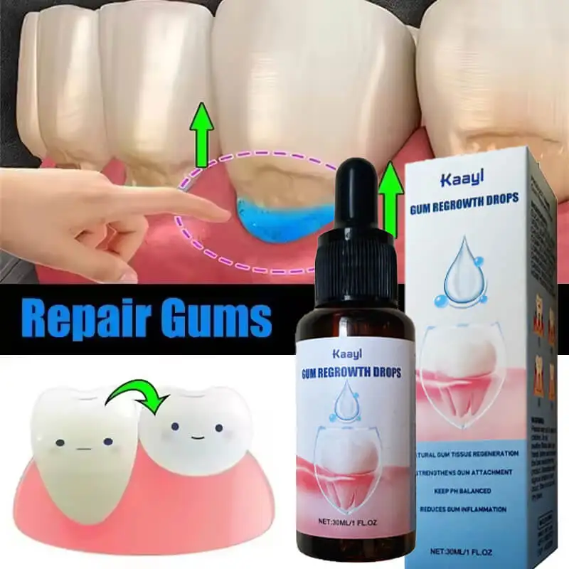 

Relieve Tooth Damage Drops | Effectively Relieve Tooth Allergy | Damaged Gum Repair Care Gel