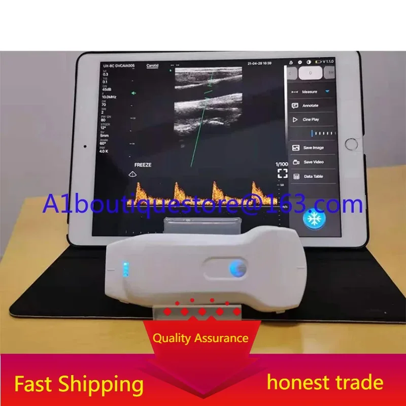 Medsinglong Color Doppler Handheld Wireless Ultrasound Scanner Portable Convex USB Wifi Double Probes Wireless Ultrasound Probe