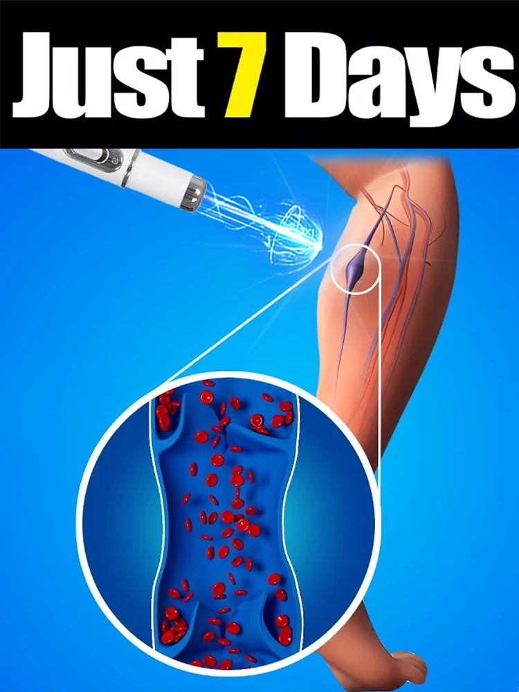 

Хит продаж, бесплатная доставка, унисекс-ручка с синим светом для лечения вен на обеих ногах, инструмент для ухода за венами