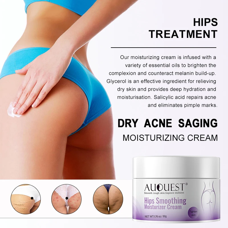 Crema idratante per il corpo Fianchi Parti intime Sbiancamento Lozione per il corpo levigante Rimozione macchie scure Cura della pelle del corpo Acquista uno prendi uno gratis