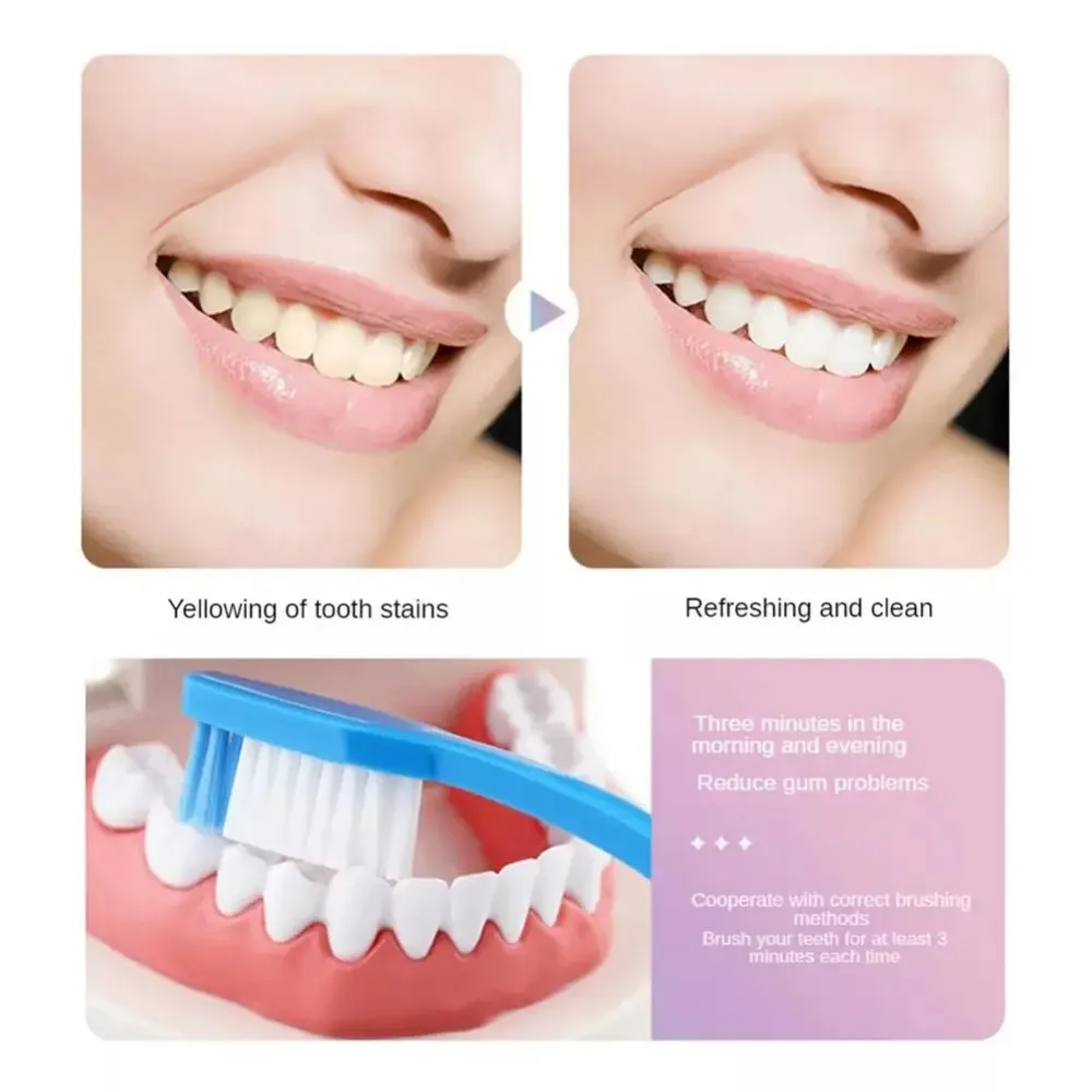 

1pc 100g Nicotinamide Whitening Toothpaste Stains Tartar Removal Fresh Breath Oral Anti-Sensitive Toothpaste for Teeth Cleaning