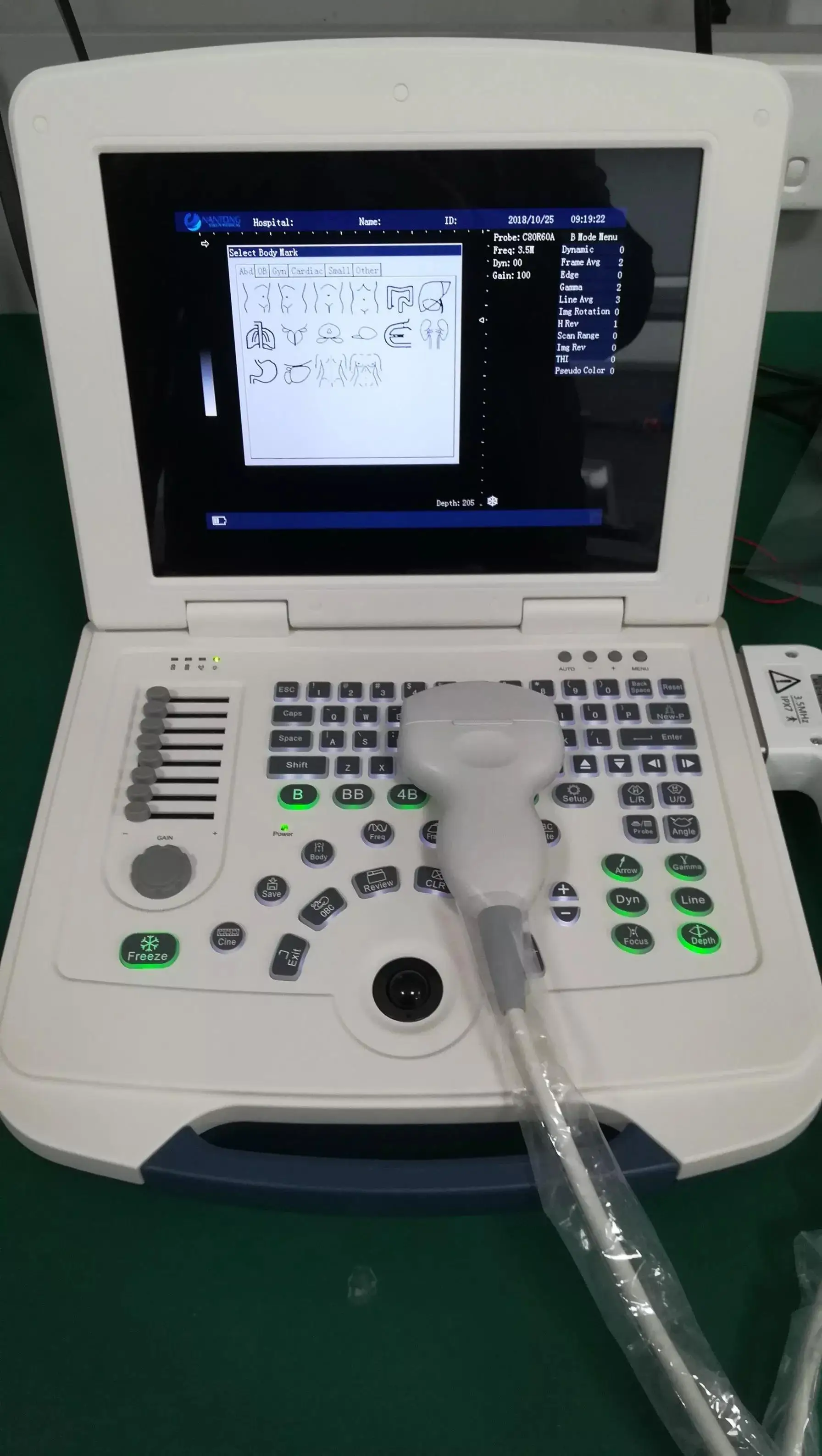 EURPET Cheap Medical Table Top Ultrasound Scanner System Ultrasound Machine With Probes Price