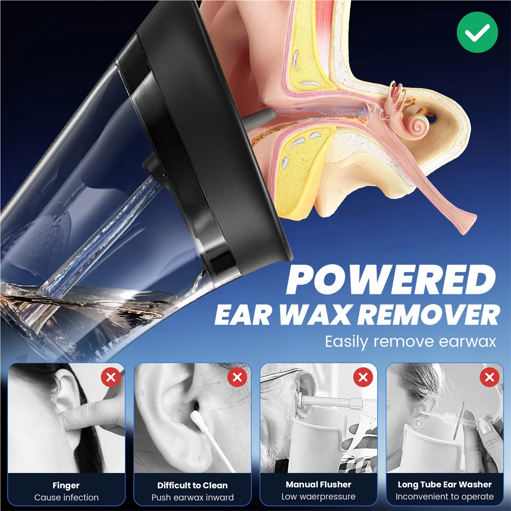 Portable Electric Ear Irrigation Cleaner Dual Water Tank Temperature Safe Sensor 4 Pressure Modes Rechargeable Ear Wax Removal