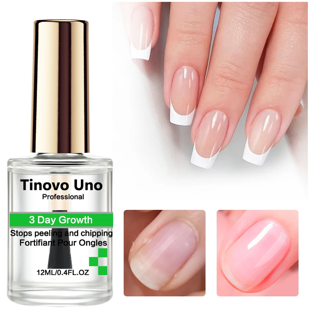 

Tinovo Uno 3-дневное лечение роста ногтей, быстрый кератиновый укрепляющий усилитель для ремонта, тонкие ногти, инструменты для ухода за маникюром